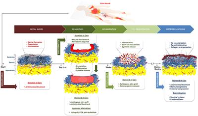 Advancements in Regenerative Strategies Through the Continuum of Burn Care